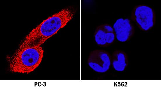 MKP-3 antibody in PC-3 and K562 Human Cell Lines by Immunocytochemistry (ICC).