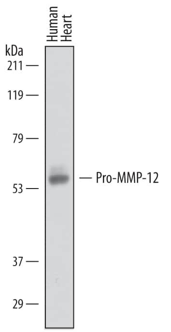 Detection of Human Pro-MMP-12 antibody by Western Blot.