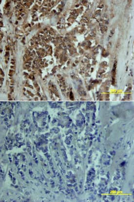 MMP-13 antibody in Human Breast by Immunohistochemistry (IHC-P).
