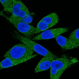 MMP-13 antibody in MDA-MB-231 Human Cell Line by Immunocytochemistry (ICC).