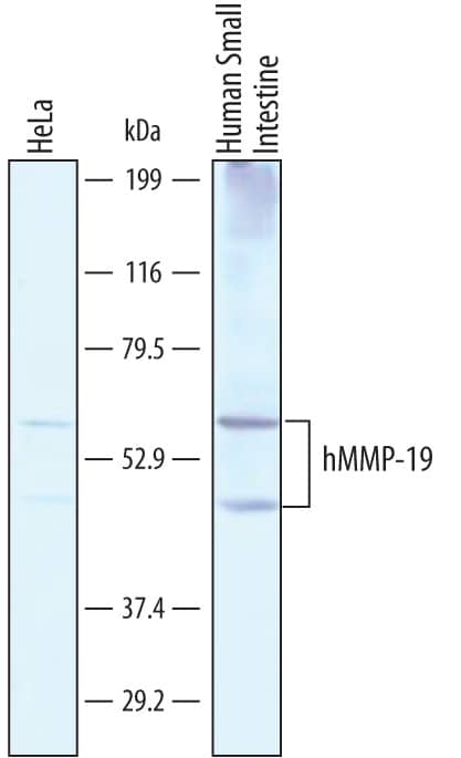 Detection of Human MMP-19 antibody by Western Blot.