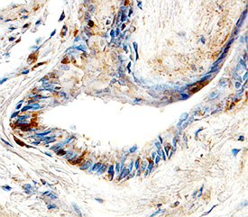 MMP-25/MT6-MMP antibody in Human Lung by Immunohistochemistry (IHC-P).