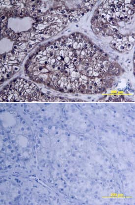 MMP-2 antibody in Human Ovary by Immunohistochemistry (IHC-P).