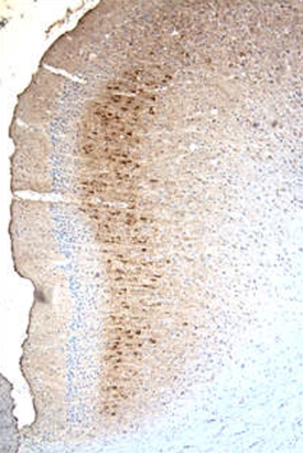 MMP-9 antibody in Rat Brain by Immunohistochemistry (IHC-Fr).