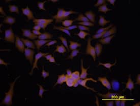 MMP-9 antibody in MCF-7 Human Cell Line by Immunocytochemistry (ICC).
