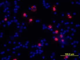 MMP-9 antibody in Mouse Splenocytes by Immunocytochemistry (ICC).