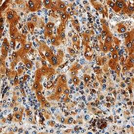 MMP-1 antibody in Human Liver by Immunohistochemistry (IHC-P).