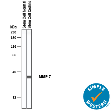 Detection of Human MMP-7 antibody by Simple WesternTM.