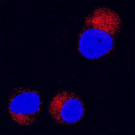 MMP-8 antibody in Jurkat Human Cell Line by Immunocytochemistry (ICC).