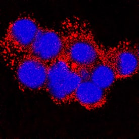 MMP-9 antibody in Mouse Splenocytes by Immunocytochemistry (ICC).