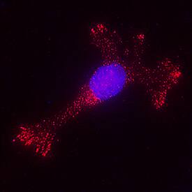 MMP-9 antibody in SW1353 Human Cell Line by Immunocytochemistry (ICC).