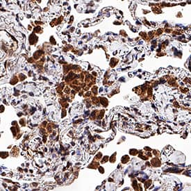 MMP-9 antibody in Human Lung by Immunohistochemistry (IHC-P).