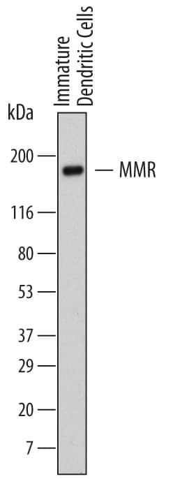 Detection of Human MMR/CD206 antibody by Western Blot.