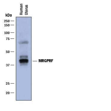 Detection of Human MRGPRF antibody by Western Blot.