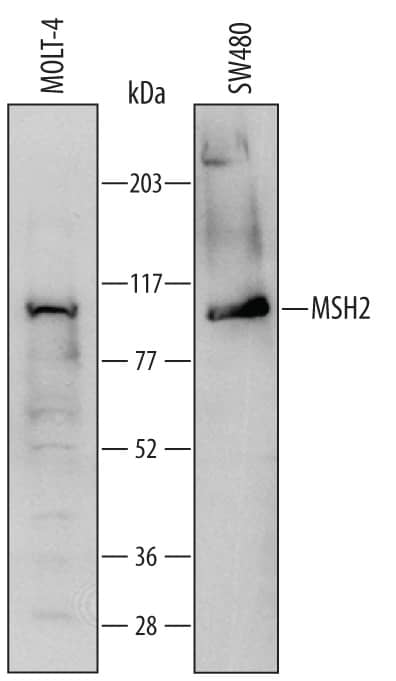 Detection of Human MSH2 antibody by Western Blot.