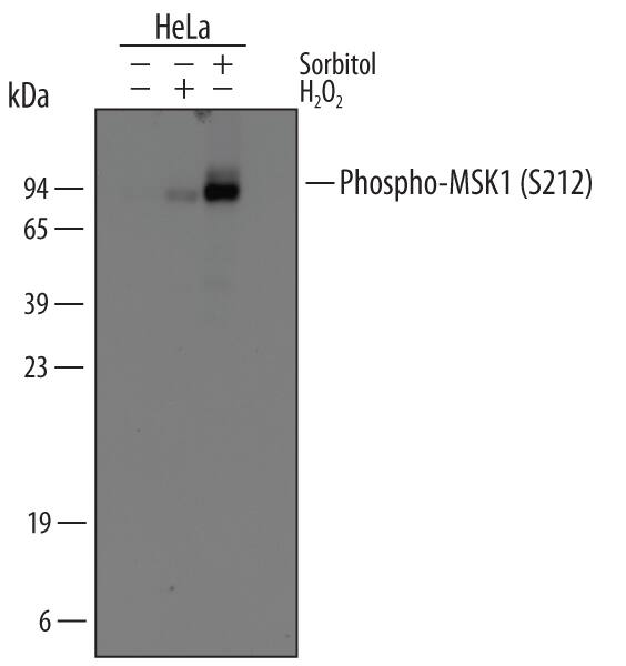 Detection of Human Phospho-MSK1 (S212) antibody by Western Blot.