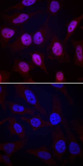 Phospho-MSK1(S376)/MSK2(S360) antibody in HeLa Human Cell Line by Immunocytochemistry (ICC).