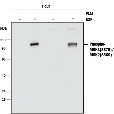 Detection of Human Phospho-MSK1 (S376)/MSK2 (S360) antibody by Western Blot.