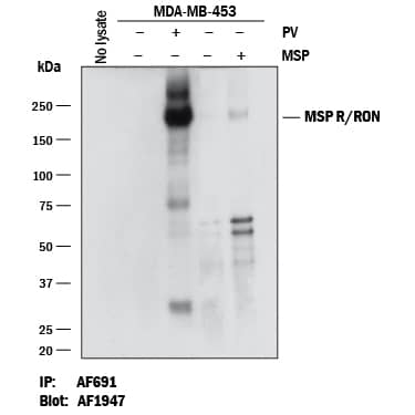 Detection of Human Phospho-MSP R/Ron (Y1238/Y1239) antibody by Western Blot.