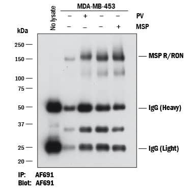 Detection of Human MSP R/Ron by Immunoprecipitation.