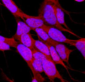 MST1/STK4 antibody in SH-SY5Y Human Cell Line by Immunocytochemistry (ICC).