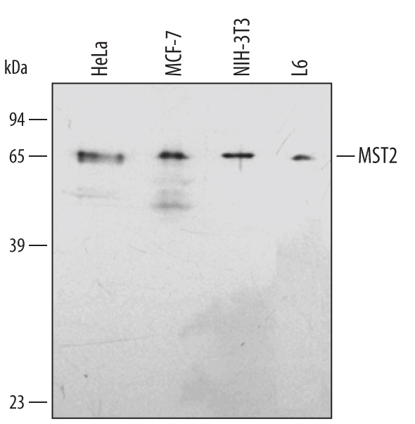 Detection of Human/Mouse/Rat MST2/STK3 antibody by Western Blot.