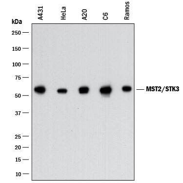 Detection of Human, Mouse, and Rat MST2/STK3 antibody by Western Blot.