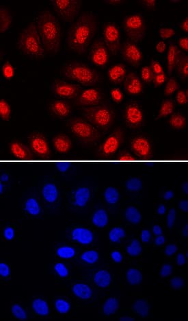 MSX2 antibody in SK-BR-3 Human Cell Line by Immunocytochemistry (ICC).