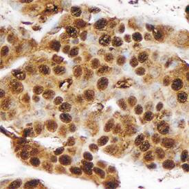 MUC-1 antibody in Human Breast by Immunohistochemistry (IHC-P).