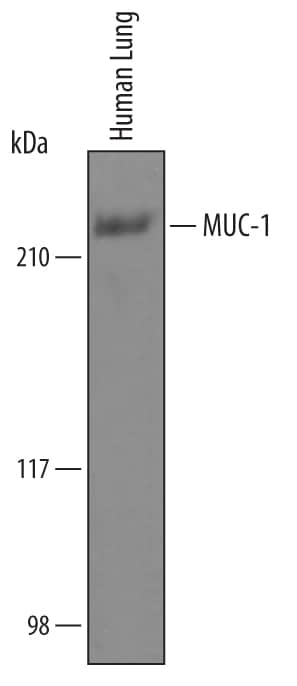 Detection of Human MUC-1 antibody by Western Blot.