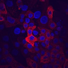 MUC-1 antibody in Capan-1 Human Cell Line by Immunocytochemistry (ICC).