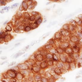 MUC-1 antibody in Human Breast by Immunohistochemistry (IHC-P).