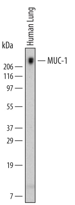 Detection of Human MUC-1 antibody by Western Blot.