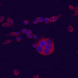 MUP-1 antibody in NCTC 1469 Mouse Cell Line by Immunocytochemistry (ICC).