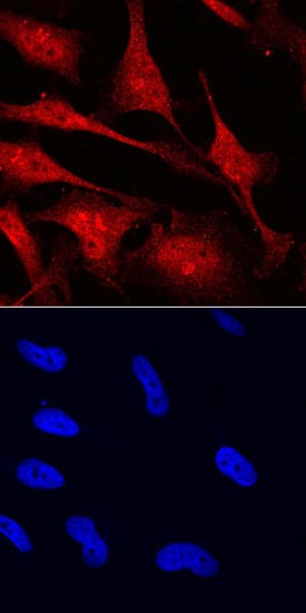 MYCL1/L-Myc antibody in HeLa Human Cell Line by Immunocytochemistry (ICC).
