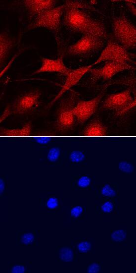 MYCL1/L-Myc antibody in NIH3T3 Mouse Cell Line by Immunocytochemistry (ICC).