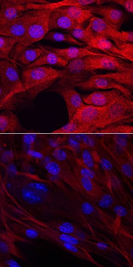 MYF-5 antibody in C2C12 Mouse Cell Line by Immunocytochemistry (ICC).