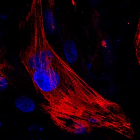 MYH6 antibody in BG01V Human Embryonic Stem Cells by Immunocytochemistry (ICC).