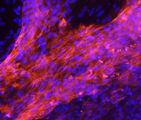 MYH7 antibody in Human Cardiomyocytes by Immunocytochemistry (ICC).