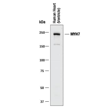 Detection of MYH7 antibody by Western Blot.