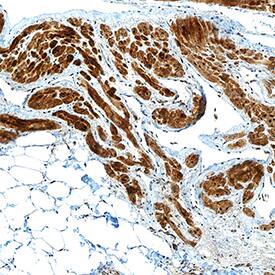 MYH7 antibody in Human Heart by Immunohistochemistry (IHC-P).