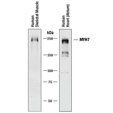 Detection of Human MYH7 antibody by Western Blot.