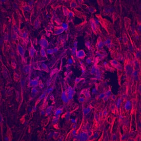 Matrilin-1 antibody in Human Mesenchymal Stem Cells by Immunocytochemistry (ICC).