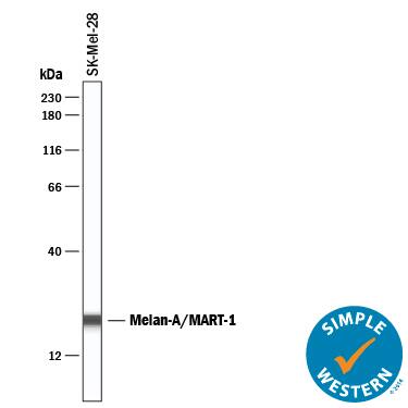 Detection of Human Melan-A/MART-1 antibody by Simple WesternTM.