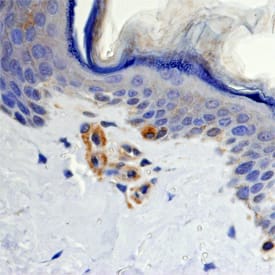 Melan-A/MART-1 antibody in Normal Human Skin by Immunohistochemistry (IHC-P).