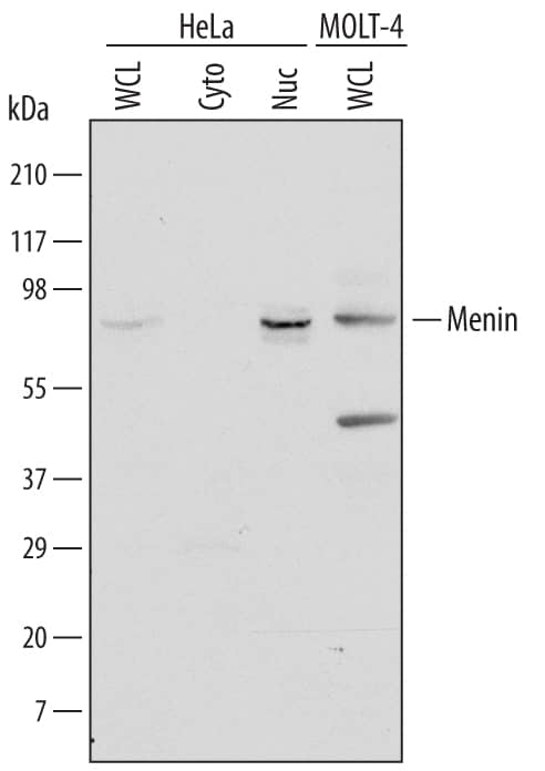 Detection of Human Menin antibody by Western Blot.