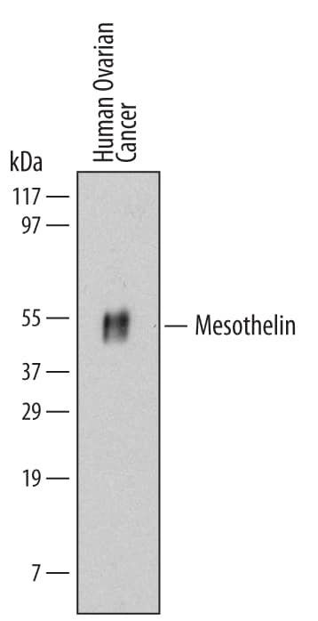 Detection of Human Mesothelin antibody by Western Blot.