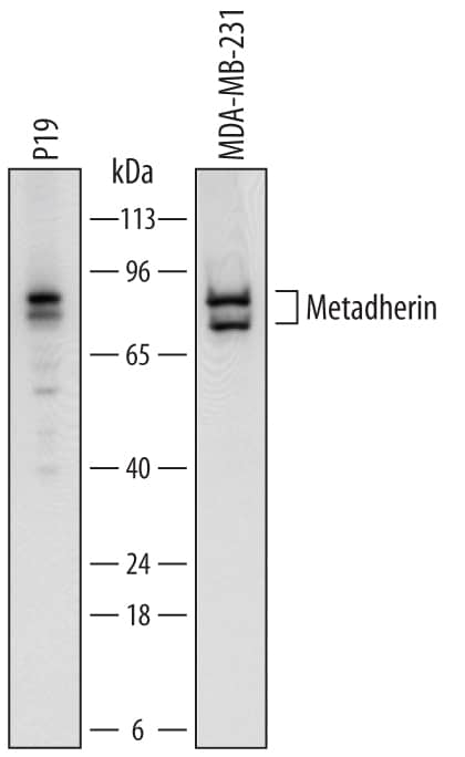 Detection of Human and Mouse Metadherin antibody by Western Blot.