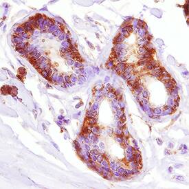 Metadherin antibody in Human Breast by Immunohistochemistry (IHC-P).