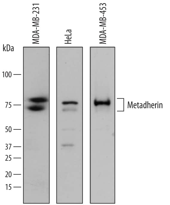 Detection of Human Metadherin antibody by Western Blot.